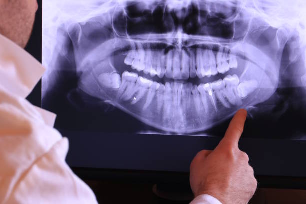 Best Emergency Dental Surgery in Legend Lake, WI